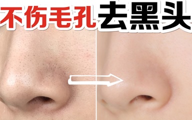 在家打造光洁肌 零损伤去黑头去角质全攻略